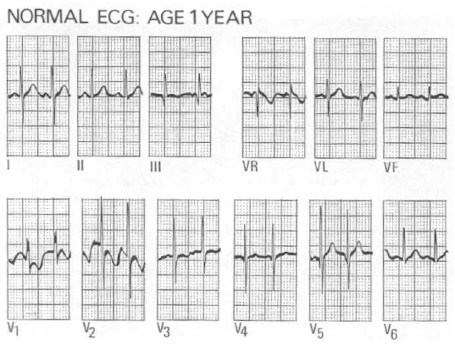 Pediyatrik Ekg Acilci Net