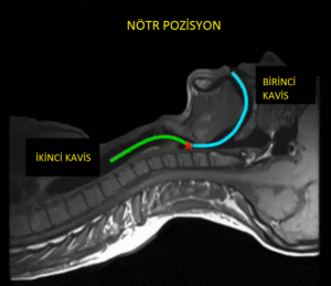 nötral pozisyon 2 curve