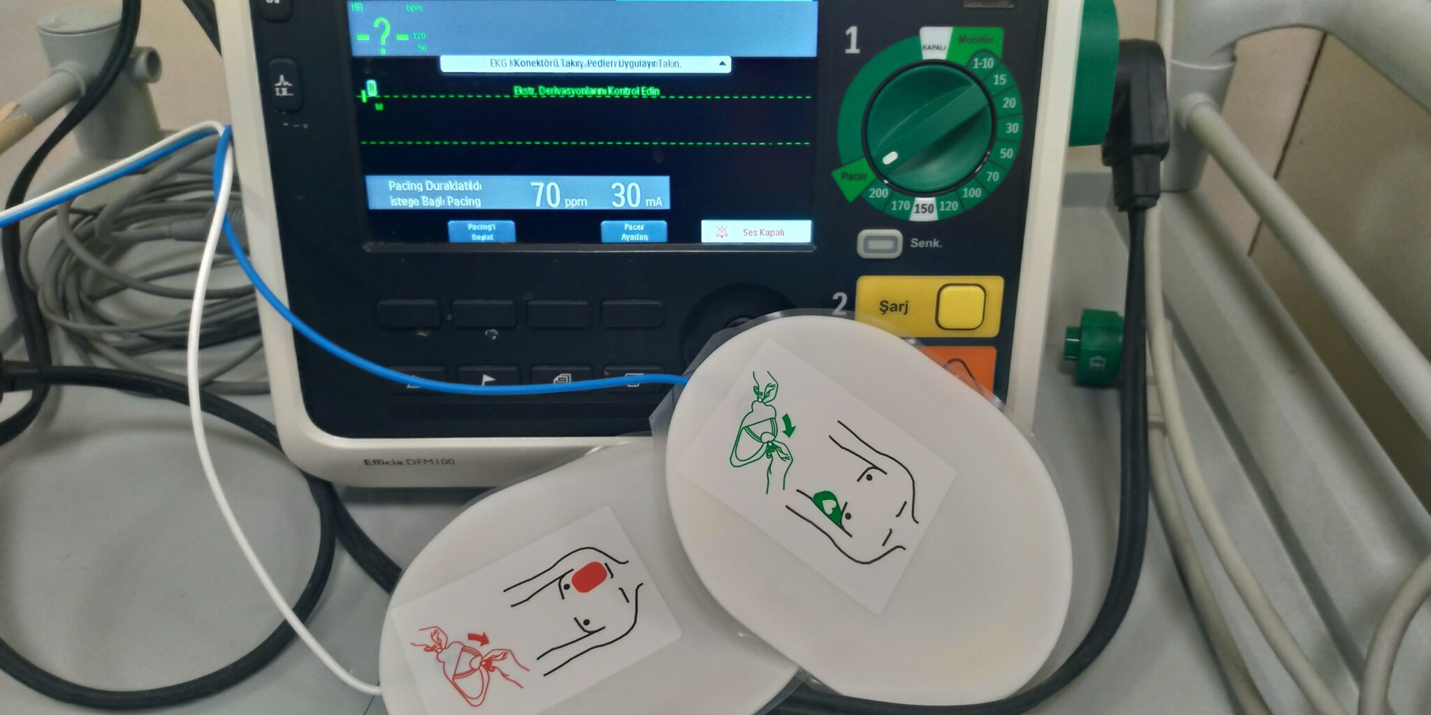Transkutan Pacemaker Uygulaması - Acilci.Net