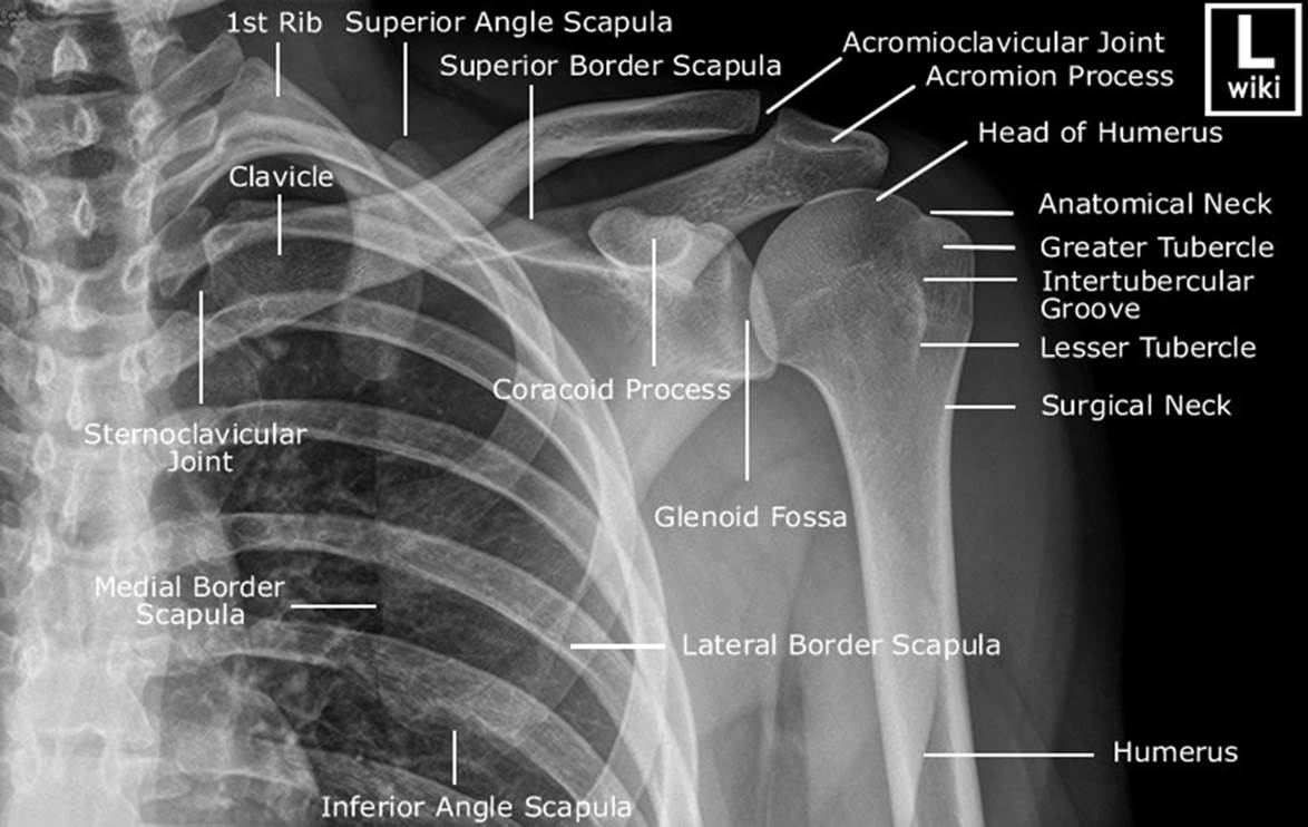 Плечевой сустав рентген анатомия