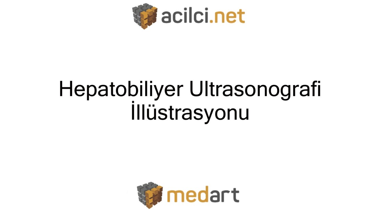 Hepatobiliyer Ultrasonografi  İllüstrasyonu
