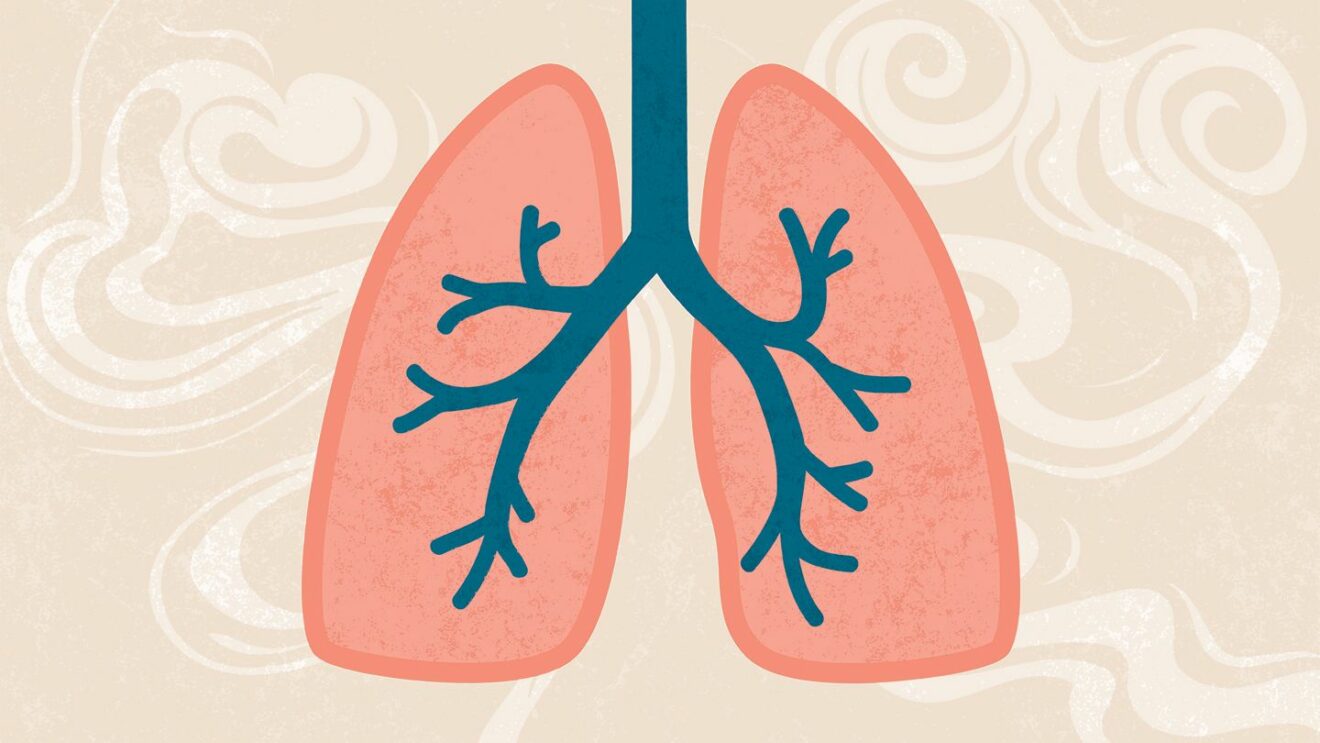 Kronik Obstruktif Akciğer Hastalığını (KOAH): Ne kadar tanıyoruz?