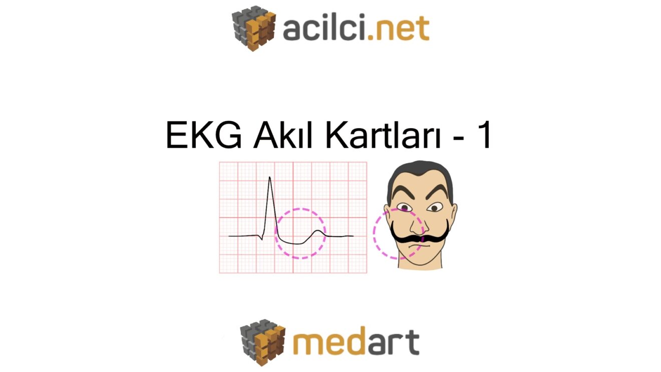 EKG Akıl Kartları - 1