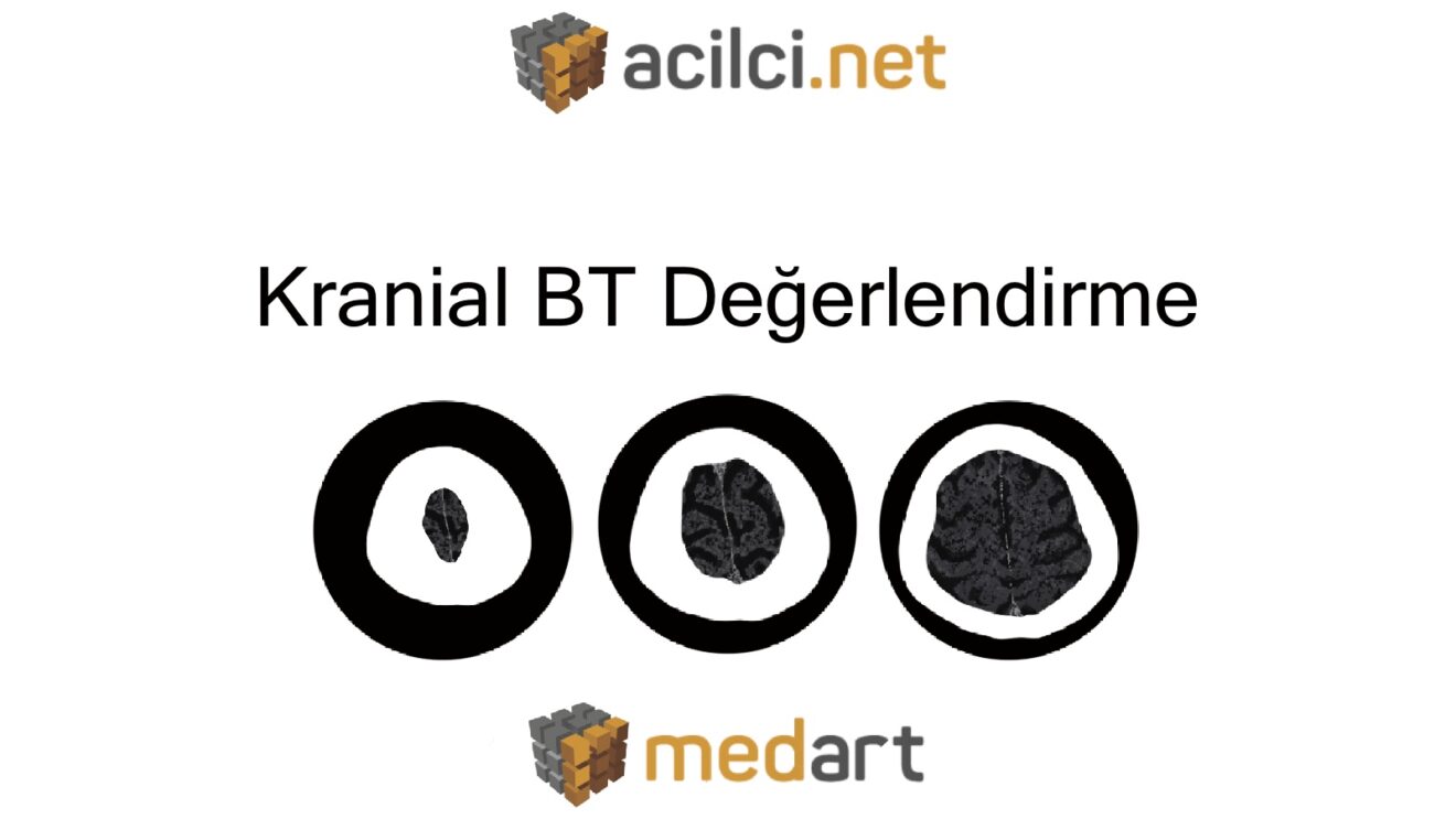 Kranial BT Değerlendirme