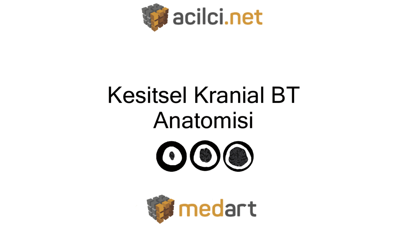 Kesitsel Kranial BT Anatomisi
